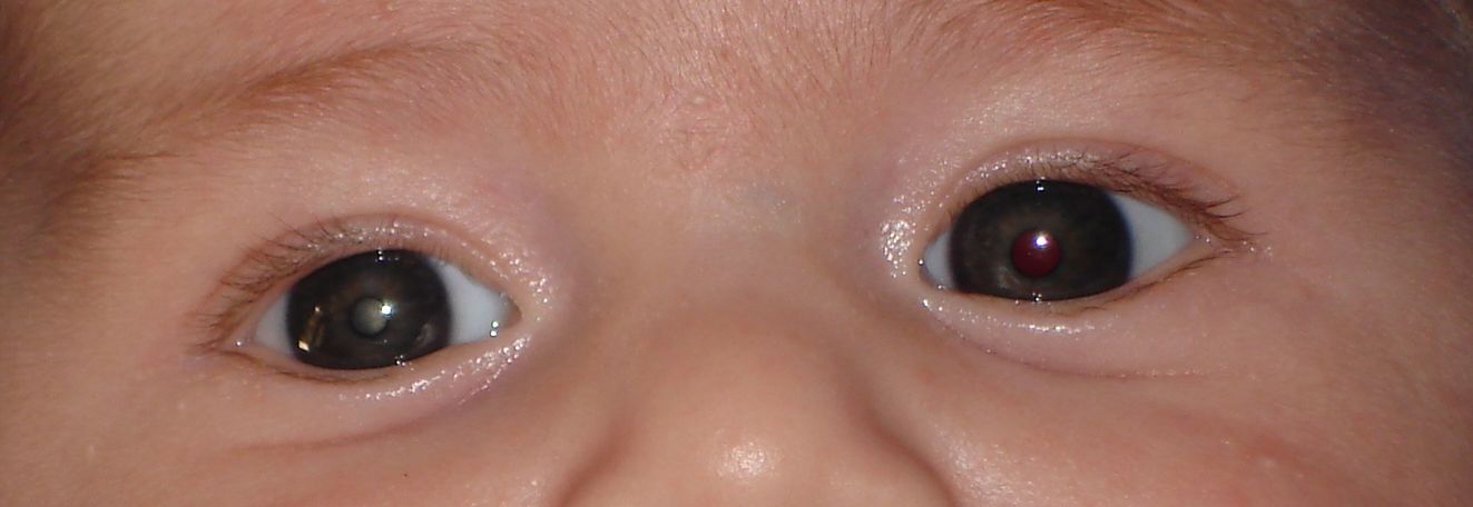 Flashs d'appareil photo : quel risque pour les yeux des bébés